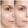 Retinol - Doctor Power Ampoules Serum - 20% Off