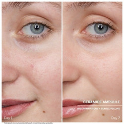 Ceramide - Doctor Power Ampoules Serum - 20% Off