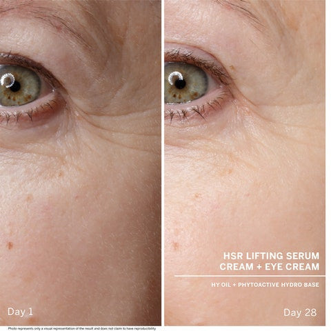 Anti-Wrinkle Serum