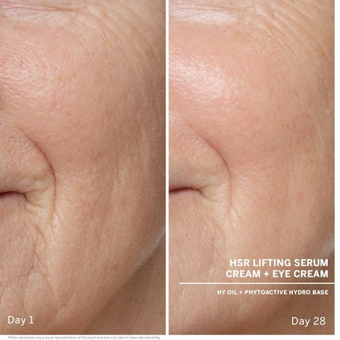 Anti-Wrinkle Serum